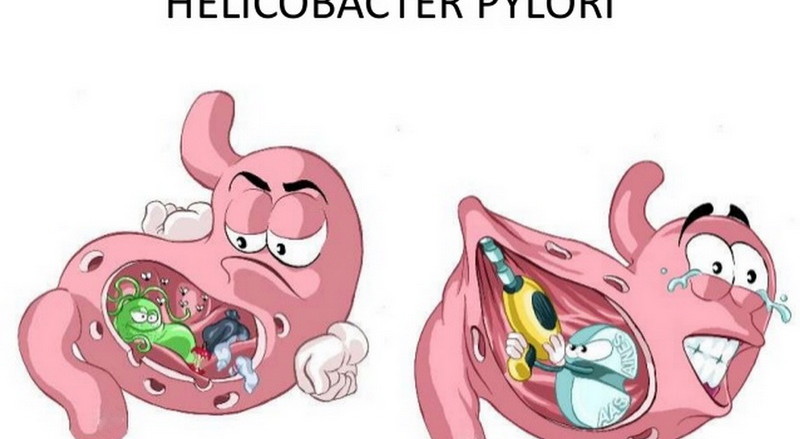helicobacter-pylori-helicobakter-pilori-ulcus-k25-k26-gastritis-k29-mother-tincture-urtinktur-teinture-mere-homeopat-tinktura-ekstrakt-biljni-preparati-com-yt1mi-blagotvorne-biljke