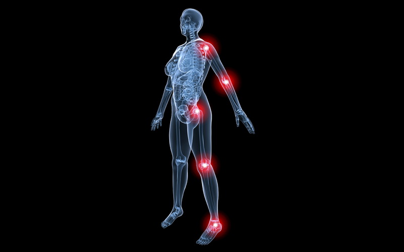 arthrosis-osteoarthritis-arthrose-artroza-m15-m19-m47-mother-tincture-urtinktur-teinture-mere-homeopat-tinktura-ekstrakt-biljni-preparati-com-yt1mi-blagotvorne-biljke