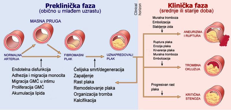 ATEROSKLEROZA STOP 6 MIX  (Formula composita ad Atherosclerosis arteriarum extremitatum I70.2 )