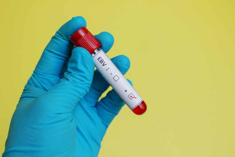 INFEKTIVNA MONONUKLEOZA (EBV) STOP 6 MIX Kompozitna formula kod infektivne mononukleoze (EBV) MKB-10 B27.0