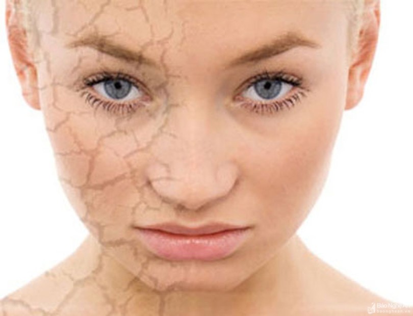 DERMATITIS (EKCEM) STOP 6 MIX Kompozizna formula kod dermatitisa (ekcema) MKB-10 L20