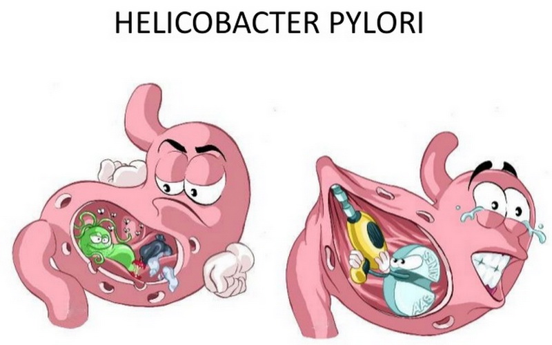 Infekcja Helicobacter Pylori Icd 10 Infekcja Helicobacter Pylori Icd 10 - Margaret Wiegel